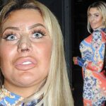 chloe ferry before surgery