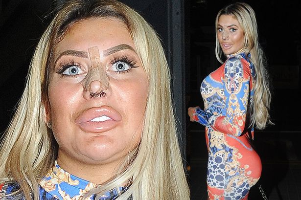 chloe ferry before surgery